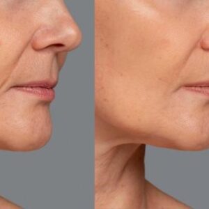 Cosmetic & Rejuvenating Treatments